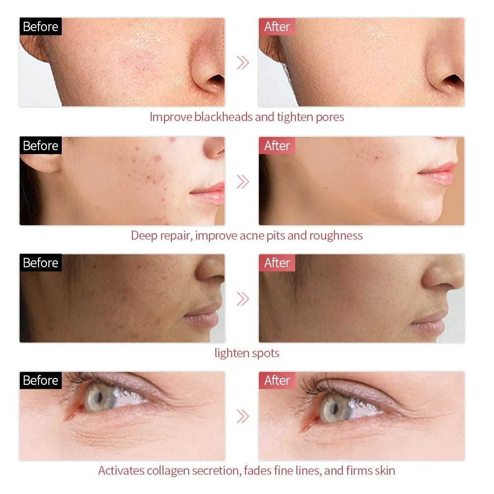 Masque LED Visage 7 Couleurs